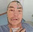 Еще одна спасенная жизнь на счету няганских медиков